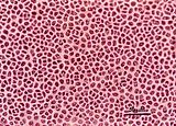 2 - Cellule corticali in visione superficiale